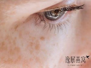 女人吃燕窝的好处和坏处有哪些?女人该不该吃燕窝