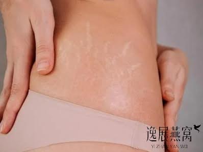 孕妇吃燕窝真的有用吗?一次讲清楚孕期吃燕窝8大的好处 孕妇吃燕窝真的有用吗?一次讲清楚孕期吃燕窝8大的好处